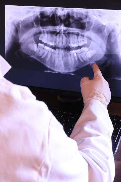 Best Emergency Dentist for Lost Fillings or Crowns in Collierville, TN