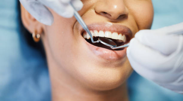 Best Broken or Cracked Tooth Emergency Dentist in Collierville, TN